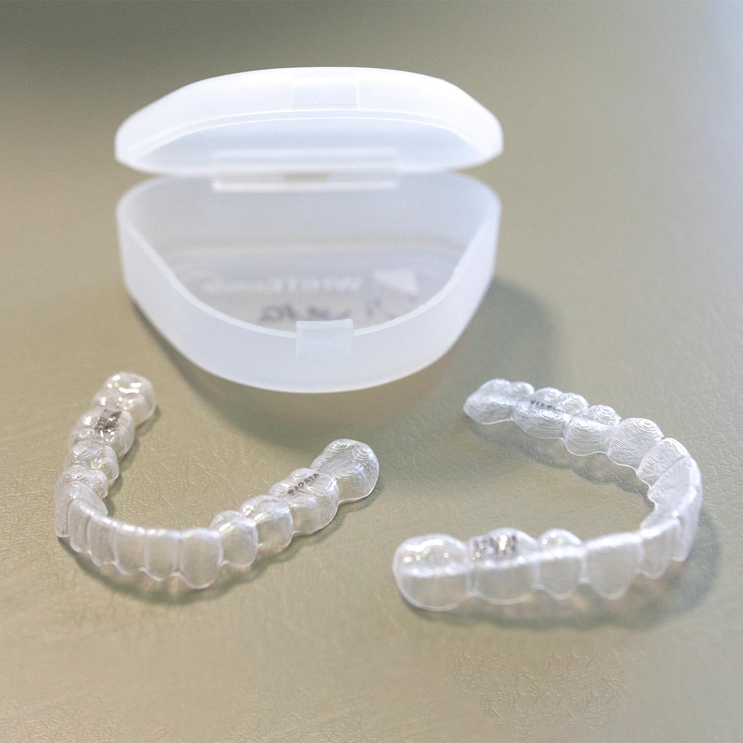 Kieferorthopädie mit Alignern – nahezu unsichtbare Schienen