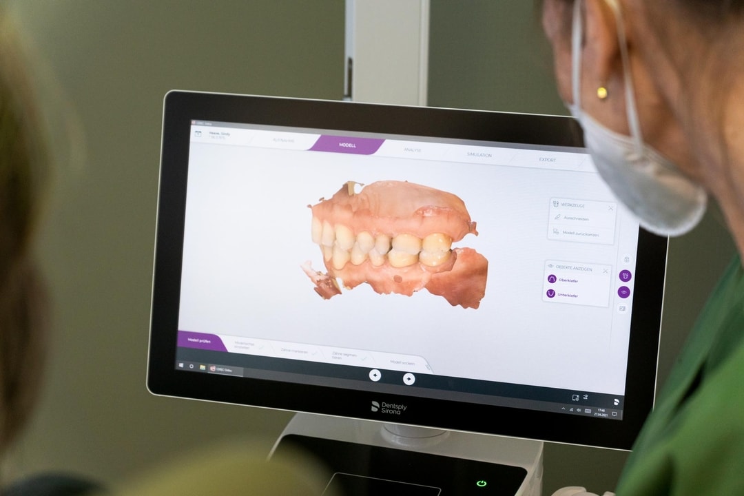 Digitaler Workflow mit Intraoralscanner
